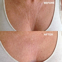 Chest Wrinkle Patch - Sare StoreWrinkle SchminklesBody Mask