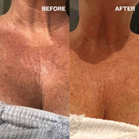 Décolletage Brightening Sheet Mask - 5 Pack - Sare StoreWrinkle SchminklesBody Mask